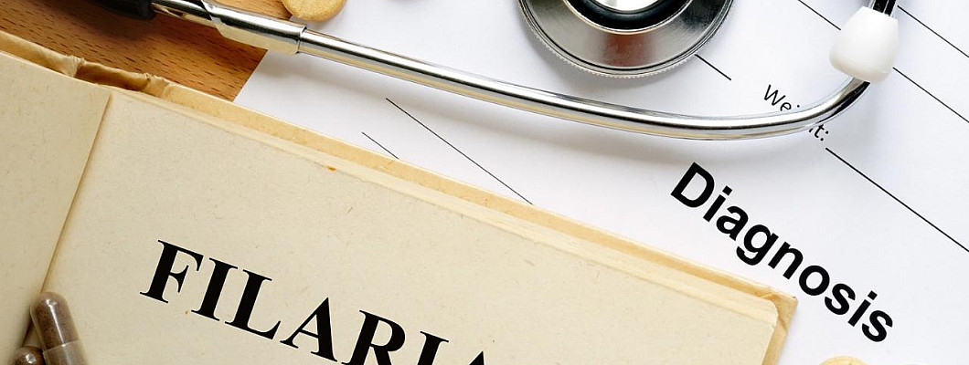 How To Cure Filariasis with the Help of Homeopathy