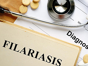 How To Cure Filariasis with the Help of Homeopathy