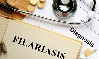 How To Cure Filariasis with the Help of Homeopathy