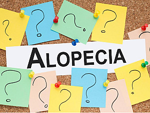 Treating Alopecia with Homeopathy: A Natural Approach to Hair Restoration
