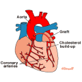  cardiac diseases