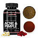 Acne and Pimple Drink Mix - Helps with Pimples, Acne, Nodules & Pustules